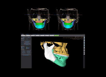 ON3D